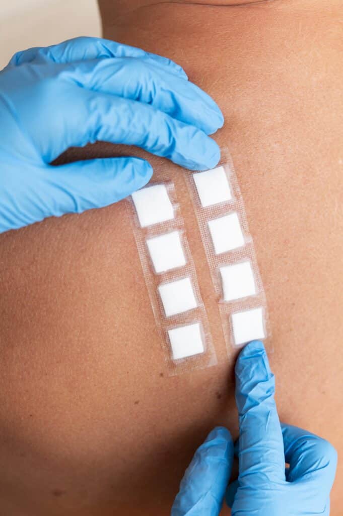 Patch Test ALLERGOLOGIA, Servizi, VISITE SPECIALISTICHE Allergologo