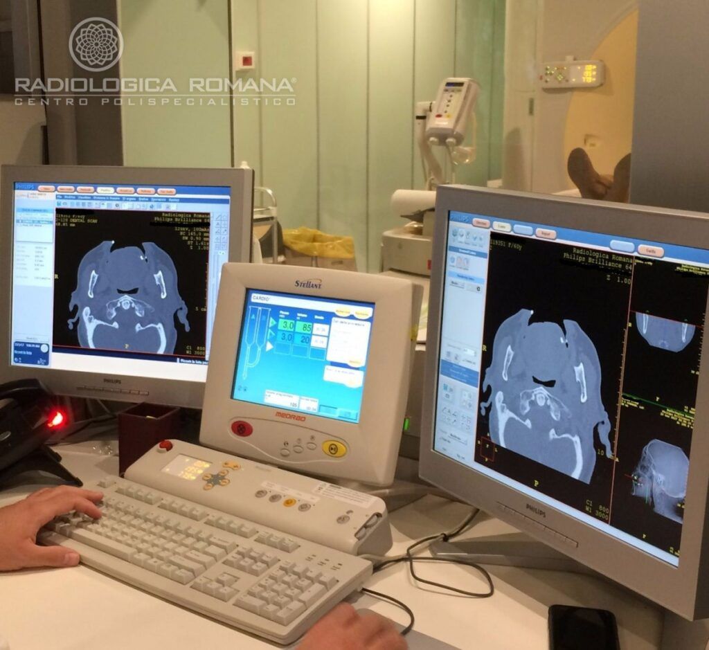 dentalscan tac diagnostica per immagini radiologia dentale